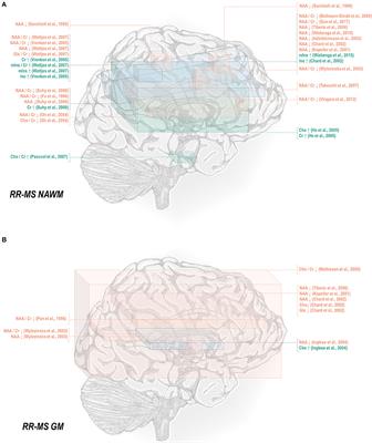 Quantifying the Metabolic Signature of Multiple Sclerosis by in vivo Proton Magnetic Resonance Spectroscopy: Current Challenges and Future Outlook in the Translation From Proton Signal to Diagnostic Biomarker